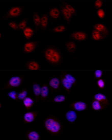 Cyclin D1 Rabbit Polyclonal Antibody - Image 4