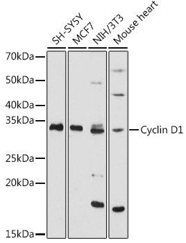 Cyclin D1 Rabbit Polyclonal Antibody