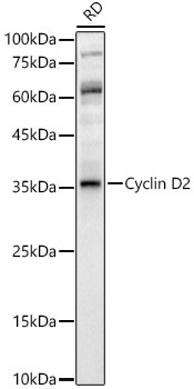Cyclin D2 Rabbit Polyclonal Antibody