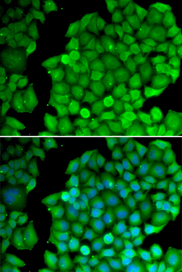 Cyclin D2 Rabbit Polyclonal Antibody - Image 2