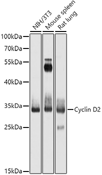 Cyclin D2 Rabbit Polyclonal Antibody