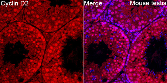 Cyclin D2 Rabbit Polyclonal Antibody