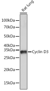 Cyclin D3 Rabbit Monoclonal Antibody - Image 2