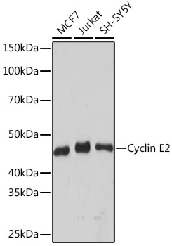 Cyclin E2 Rabbit Monoclonal Antibody - Image 2