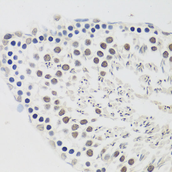 Cyclin E2 Rabbit Polyclonal Antibody - Image 2
