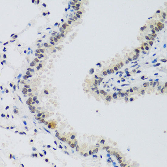 Cyclin E2 Rabbit Polyclonal Antibody - Image 3