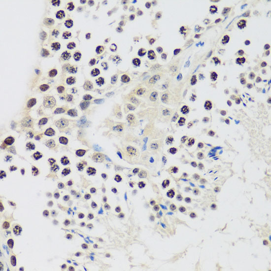 Cyclin E2 Rabbit Polyclonal Antibody - Image 4
