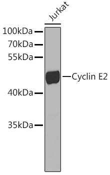 Cyclin E2 Rabbit Polyclonal Antibody
