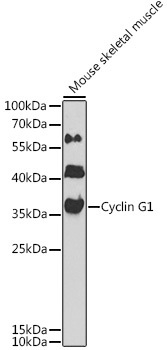 Cyclin G1 Rabbit Polyclonal Antibody