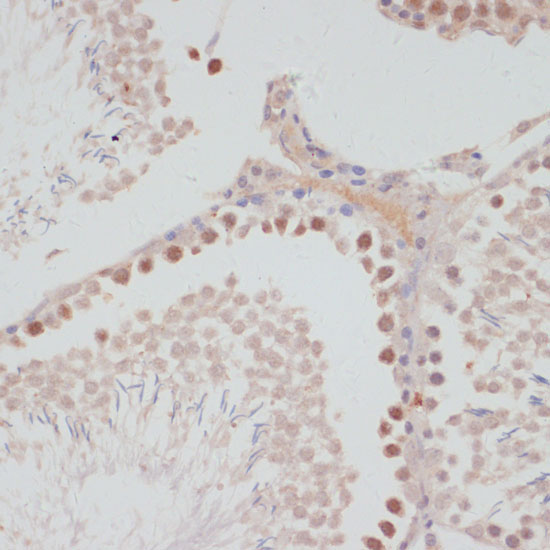 Cyclin G1 Rabbit Polyclonal Antibody - Image 2