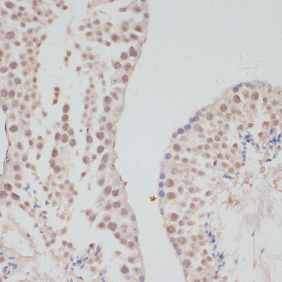 Cyclin G1 Rabbit Polyclonal Antibody - Image 3