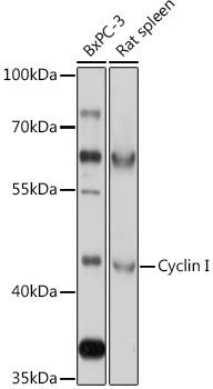 Cyclin I Rabbit Polyclonal Antibody
