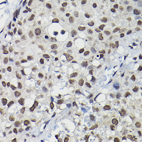 Cyclin K Rabbit Polyclonal Antibody - Image 2