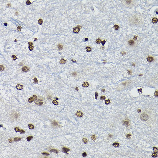 Cyclin K Rabbit Polyclonal Antibody - Image 3