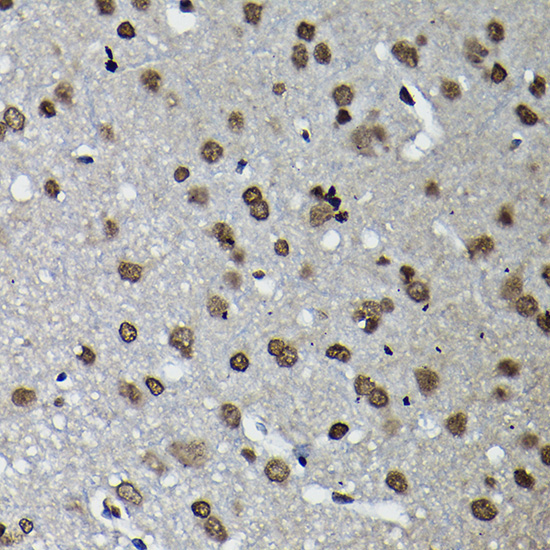 Cyclin K Rabbit Polyclonal Antibody - Image 4