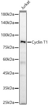 Cyclin T1 Rabbit Polyclonal Antibody