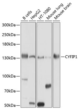 CYFIP1 Rabbit Polyclonal Antibody