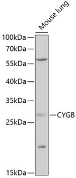 CYGB Rabbit Polyclonal Antibody