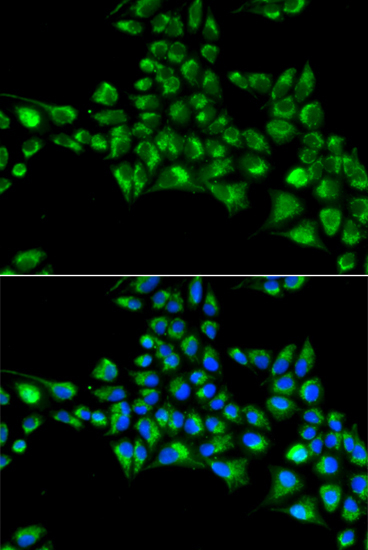 CYGB Rabbit Polyclonal Antibody - Image 2