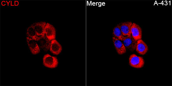CYLD Rabbit Polyclonal Antibody
