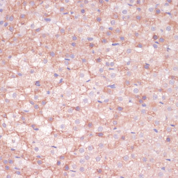 CYP11B2 Rabbit Polyclonal Antibody - Image 2