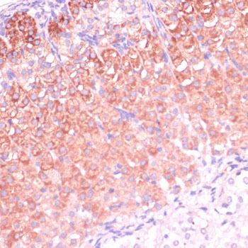 CYP11B2 Rabbit Polyclonal Antibody - Image 3