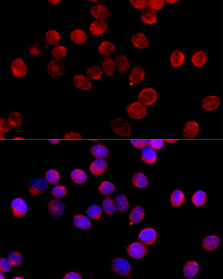CYP11B2 Rabbit Polyclonal Antibody - Image 4
