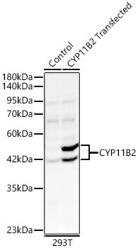 CYP11B2 Rabbit Polyclonal Antibody