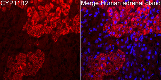 CYP11B2 Rabbit Polyclonal Antibody - Image 2