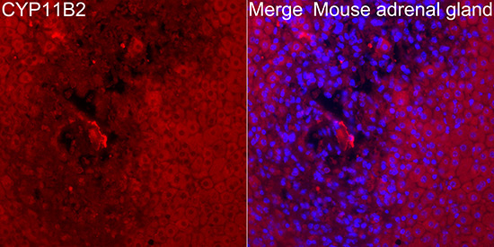 CYP11B2 Rabbit Polyclonal Antibody - Image 3