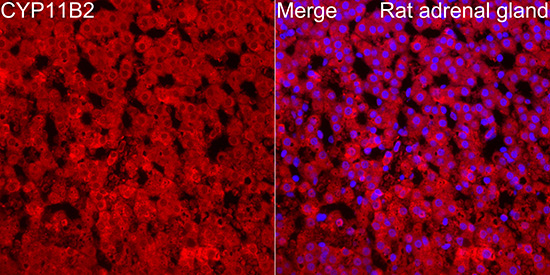 CYP11B2 Rabbit Polyclonal Antibody - Image 4