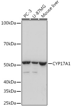 CYP17A1 Rabbit Monoclonal Antibody