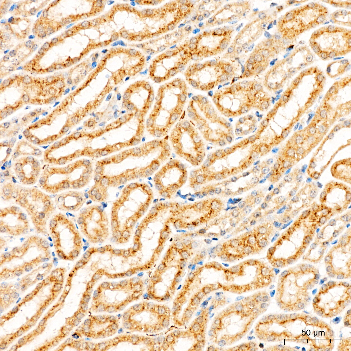 CYP1A1 Rabbit Polyclonal Antibody - Image 2