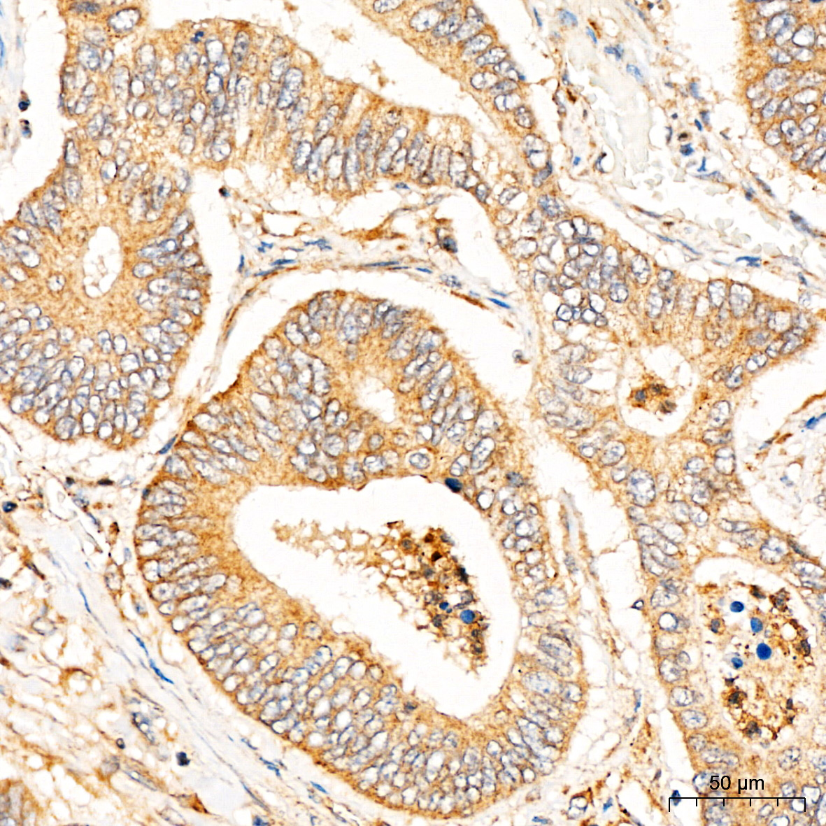 CYP1A1 Rabbit Polyclonal Antibody - Image 3