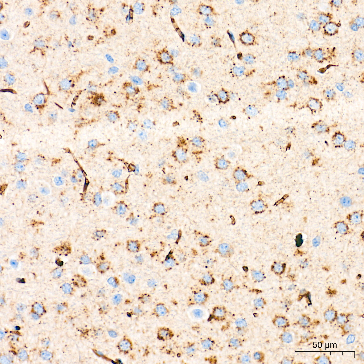 CYP1A1 Rabbit Polyclonal Antibody - Image 5