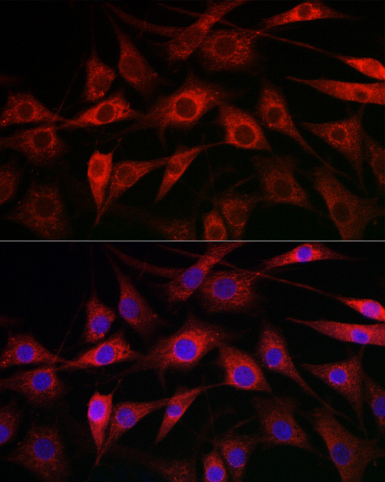CYP1A1 Rabbit Polyclonal Antibody - Image 7