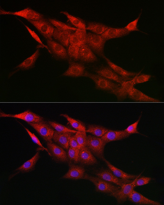 CYP1A1 Rabbit Polyclonal Antibody - Image 8