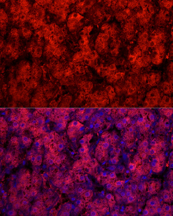 CYP1A2 Rabbit Polyclonal Antibody - Image 2