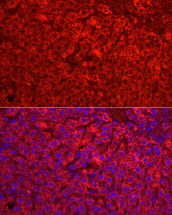 CYP1A2 Rabbit Polyclonal Antibody - Image 3