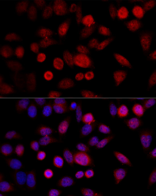 CYP1B1 Rabbit Polyclonal Antibody - Image 2