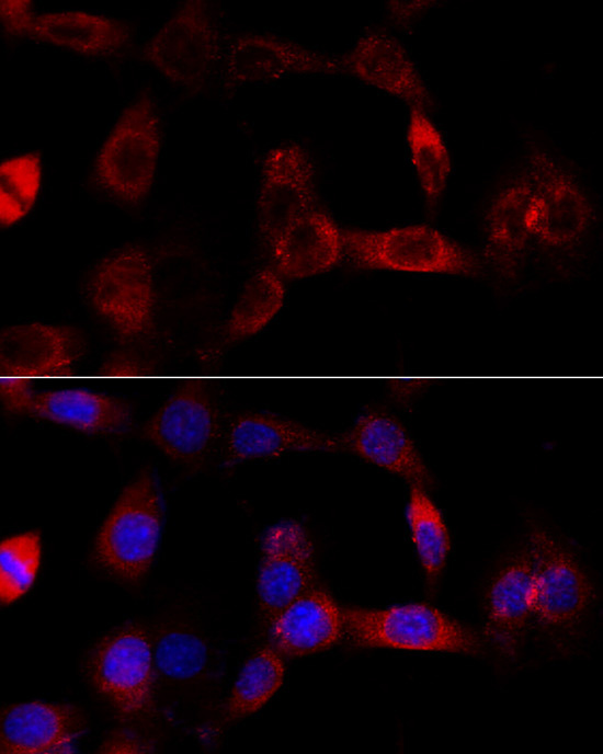 CYP1B1 Rabbit Polyclonal Antibody - Image 3