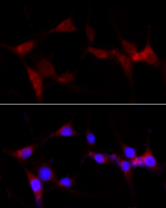 CYP1B1 Rabbit Polyclonal Antibody - Image 4