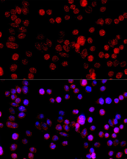 CYP1B1 Rabbit Polyclonal Antibody