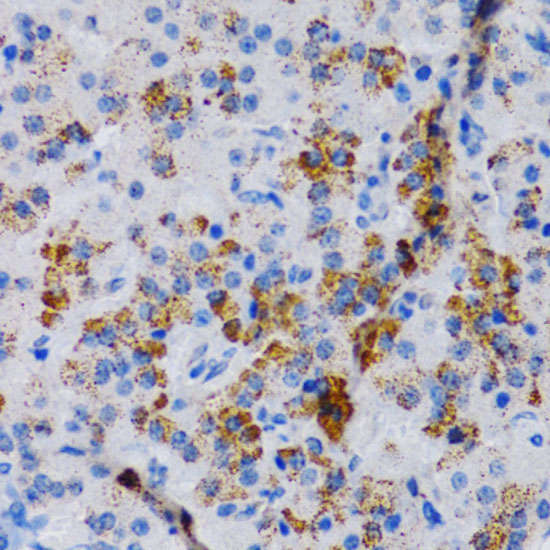 CYP24A1 Rabbit Polyclonal Antibody - Image 2