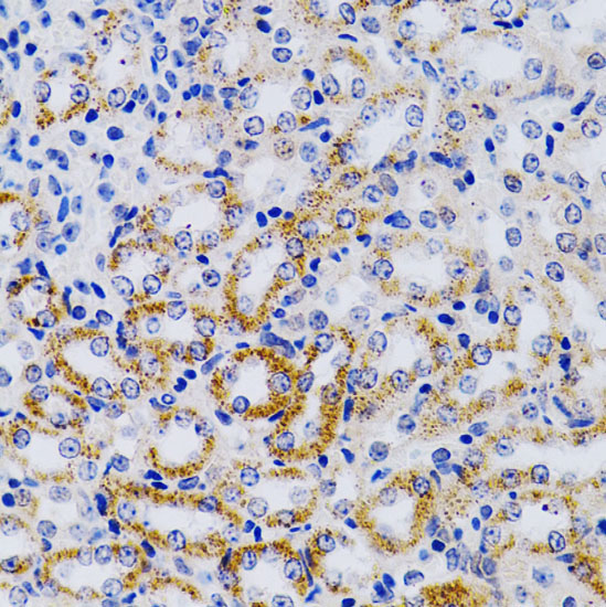 CYP24A1 Rabbit Polyclonal Antibody - Image 3