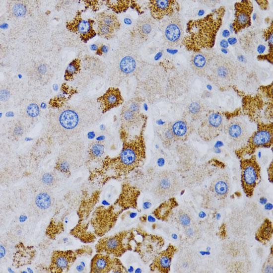 CYP24A1 Rabbit Polyclonal Antibody - Image 4