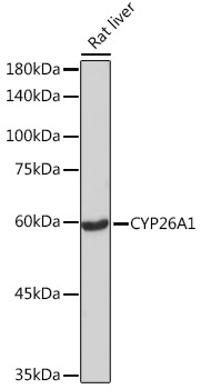 CYP26A1 Rabbit Monoclonal Antibody