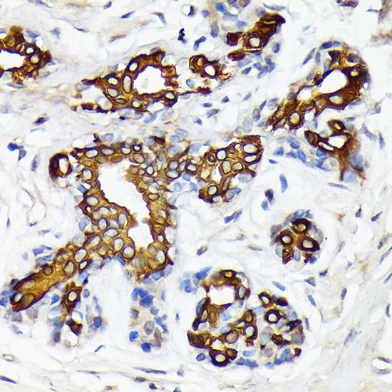CYP26A1 Rabbit Monoclonal Antibody - Image 2