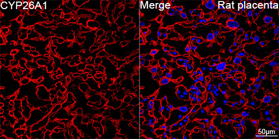 CYP26A1 Rabbit Monoclonal Antibody - Image 3