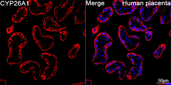 CYP26A1 Rabbit Monoclonal Antibody - Image 4